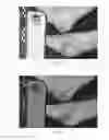 Fig. 06 - DETECTING EARLY TISSUE DAMAGE RESULTING FROM MECHANICAL DEFORMATION, SHEAR, FRICTION, AND/OR PROLONGED APPLICATION OF PRESSURE