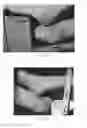 Fig. 07 - DETECTING EARLY TISSUE DAMAGE RESULTING FROM MECHANICAL DEFORMATION, SHEAR, FRICTION, AND/OR PROLONGED APPLICATION OF PRESSURE