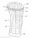 Fig. 01 - KNEE BRACE PROVIDING DYNAMIC DATA