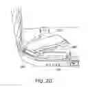 Fig. 03 - Displays for a medical device