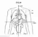 Fig. 07 - X-ray CT apparatus