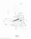 Fig. 02 - Augmented suture construct for syndesmotic stabilization