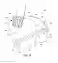 Fig. 09 - Augmented suture construct for syndesmotic stabilization