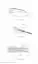 Fig. 10 - Apparatus and method for resectioning gastro-esophageal tissue