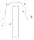 Fig. 02 - Left atrial appendage occluder device anchoring system, anchor, and method of attachment