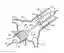 Fig. 01 - Method and system for balloon counterpulsation during aortic valve replacement