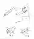 Fig. 03 - Method and system for balloon counterpulsation during aortic valve replacement
