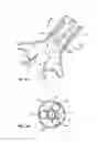 Fig. 04 - Method and system for balloon counterpulsation during aortic valve replacement