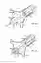 Fig. 07 - Method and system for balloon counterpulsation during aortic valve replacement