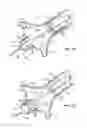 Fig. 08 - Method and system for balloon counterpulsation during aortic valve replacement