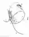 Fig. 07 - Transradial sheath support and hemostasis device and method
