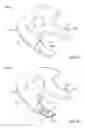 Fig. 06 - Method and apparatus for manufacturing an implant