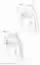 Fig. 02 - Shockwave valvuloplasty catheter system