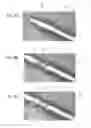 Fig. 05 - DEVICE FOR CLEAN EXCISION OF A HEART VALVE