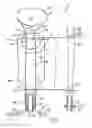 Fig. 02 - Postpartum hemorrhage balloon system