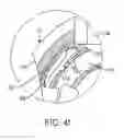 Fig. 09 - Interspinous spacer