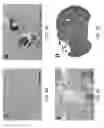 Fig. 07 - Immunotherapeutic methods using irreversible electroporation