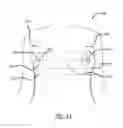 Fig. 09 - Real-time surgical reference guides and methods for surgical applications