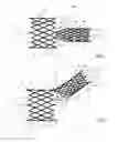 Fig. 02 - Stent for using in bifurcations
