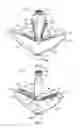Fig. 03 - Prosthetic spacer device for heart valve
