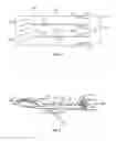 Fig. 04 - Prosthetic spacer device for heart valve