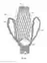 Fig. 06 - Prosthetic spacer device for heart valve