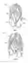 Fig. 08 - Prosthetic spacer device for heart valve