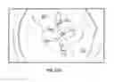 Fig. 20 - Prosthetic spacer device for heart valve
