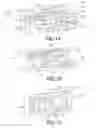 Fig. 02 - Plastically deformable inter-osseous device
