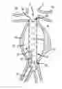 Fig. 01 - Methods and systems for aneurysm stabilization and treatment