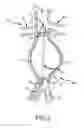 Fig. 06 - Methods and systems for aneurysm stabilization and treatment