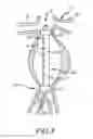 Fig. 08 - Methods and systems for aneurysm stabilization and treatment