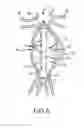 Fig. 09 - Methods and systems for aneurysm stabilization and treatment