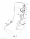 Fig. 02 - Rigid ankle support system