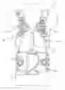 Fig. 01 - Thoracic lumbar sacral orthosis attachment