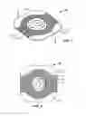 Fig. 02 - ADHESIVE FOR MOIST TISSUE AND PERISTOMAL DEVICE MADE USING THE SAME