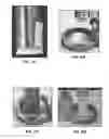 Fig. 09 - ADHESIVE FOR MOIST TISSUE AND PERISTOMAL DEVICE MADE USING THE SAME