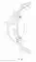 Fig. 02 - Method, device and system for treatment of elevated intraocular pressure