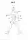 Fig. 02 - Method and device for outputting torque of walking assistance device