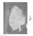 Fig. 04 - Stable silk fibroin based pharmaceutical formulations