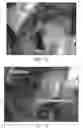 Fig. 09 - SPRAYABLE POLYMERS AS ADHESION BARRIERS