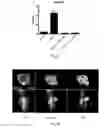 Fig. 05 - Small molecules for dual function positron emission tomography (PET) and cell suicide switches