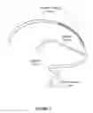 Fig. 02 - SYSTEM AND METHODS FOR ACCESSING AND TREATING CEREBRAL VENOUS SINUS THROMBOSIS