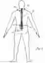 Fig. 02 - Drill assembly for accessing bone