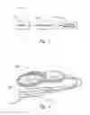Fig. 02 - VESTIBULAR PROSTHESES AND ASSOCIATED SYSTEMS AND METHODS