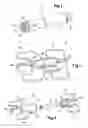 Fig. 02 - COMMUNICATION AMPLIFICATION DEVICE COMPRISING RETENTION ELEMENTS FOR AN IMPLANTABLE CAPSULE