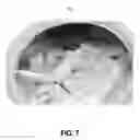 Fig. 08 - Systems and methods of filtering particulate matter from a fluid