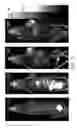 Fig. 04 - MULTIPLE-FUNCTIONAL PROBE AND USES THEREOF