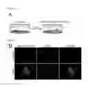 Fig. 02 - METHOD FOR DIRECTLY PRODUCING CARDIAC PRECURSOR CELL OR MYOCARDIAL CELL FROM FIBROBLAST