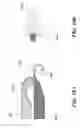 Fig. 26 - Isotachophoresis for purification of nucleic acids
